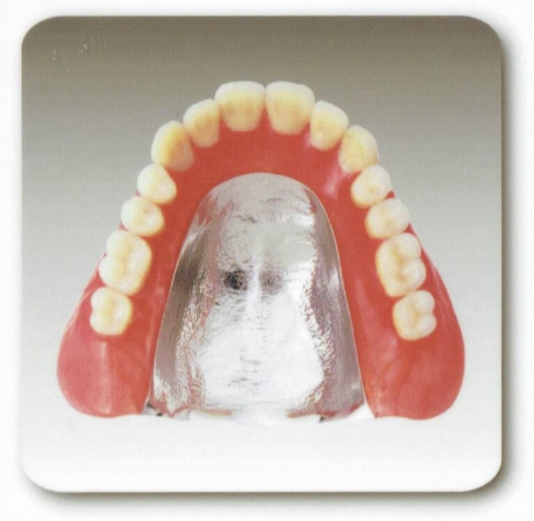 コバルトクロムの入れ歯